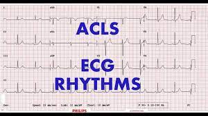 ACLS Rhythm & Algorithm Review