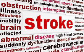 Stroke (1.5hrs) (DE)